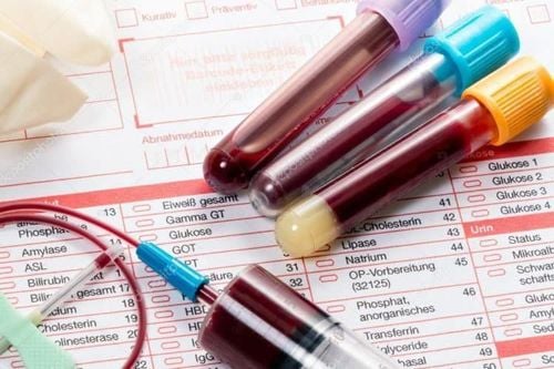 Blood tests help diagnose sexually transmitted infections (STIs).