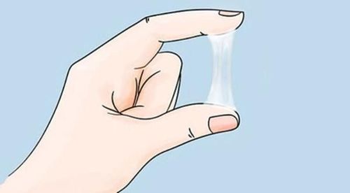 Tình trạng huyết trắng có mùi tanh ở phụ nữ