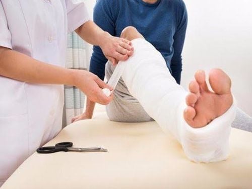 Bó bột cố định gãy xương chân