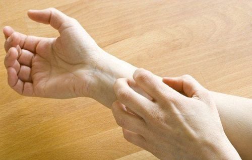 Itching is an early sign of shingles
