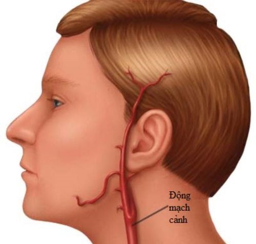 External carotid artery ligation surgery procedure
