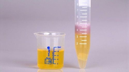 Xét nghiệm Nitrate giúp chẩn đoán tình trạng nhiễm trùng đường tiểu