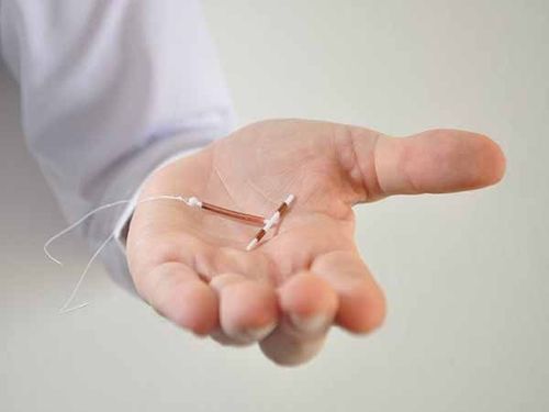 Women can use intrauterine devices (IUDs) as an effective method of contraception.