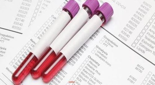 Xét nghiệm HBeAg là bằng chứng chứng tỏ virus viêm gan B đang hoạt động.