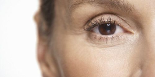 Sưng một bên mắt sau mổ u ác tuyến giáp vét hạch là do đâu?