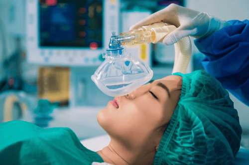 Cấy ghép implant xương gò má được thực hiện gây mê toàn thân