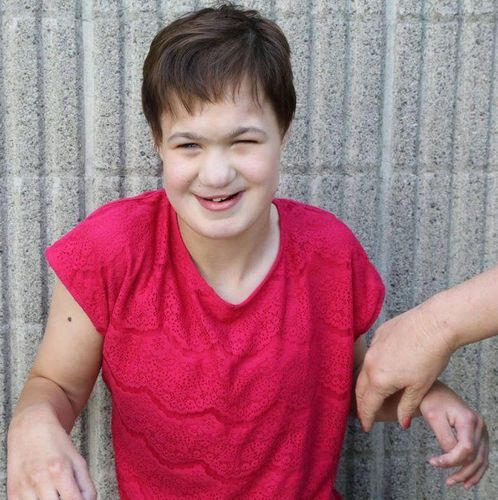 Trisomy 13 (Hội chứng Patau): Triệu chứng, Chẩn đoán và Các Lựa chọn Chăm sóc 