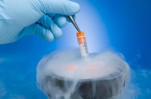 Thụ tinh trong ống nghiệm IVF là phương pháp hỗ trợ sinh sản hiện đại