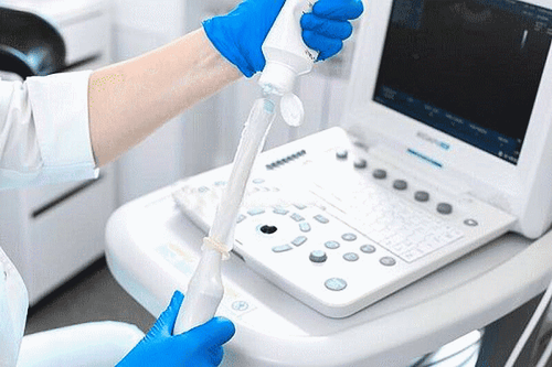 
Siêu âm đầu dò giúp bác sĩ xác định được vị trí chính xác của túi thai và phôi thai ngoài tử cung
