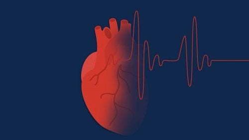 Diphenhyd-PE-Acetaminophen có thể gây tăng nhịp tim ở người bệnh
