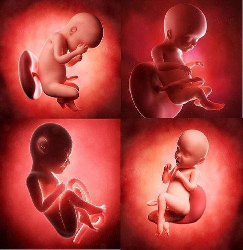 Dị tật thai nhi là những khiếm khuyết trên cơ thể trẻ trong giai đoạn mang thai