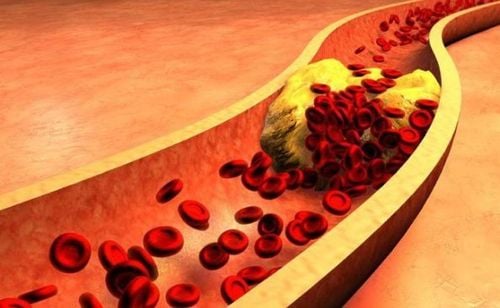 Bee Pollen Reduces the Risk of Cardiovascular Disease