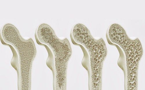 Adding basa fish to your diet helps improve bone quality.