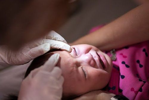 Cha mẹ không nên tự ý chữa mắt cho trẻ khi chưa có hướng dẫn của bác sĩ
