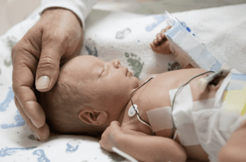 
Trẻ sơ sinh cần được theo dõi nhịp tim, nhịp thở chặt chẽ bằng máy theo dõi tim phổi
