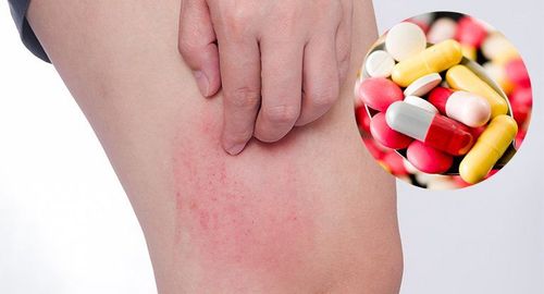 Làm thế nào hạn chế nguy cơ dị ứng thuốc?