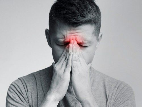 Cách điều trị viêm xoang?