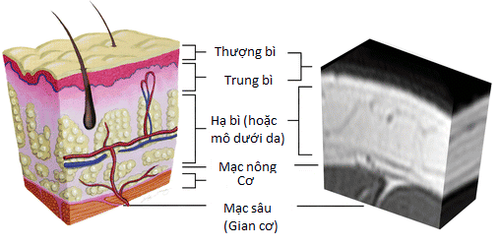 Hình 1. Hình ảnh giải phẫu da