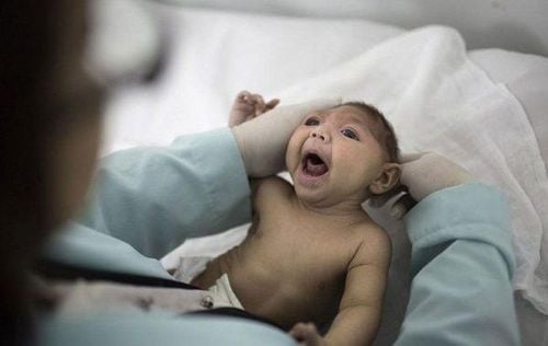 Brain atrophy is a syndrome of brain tissue shrinking due to the loss of brain cells or the destruction of nerve connections. 