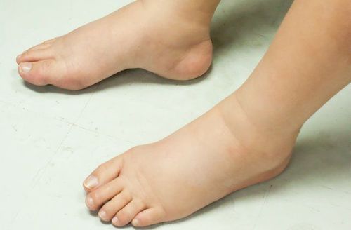 Slide item