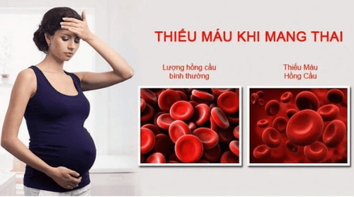 Tình trạng thiếu máu khi mang thai gây ảnh hưởng đến sức khỏe mẹ bầu và thai nhi