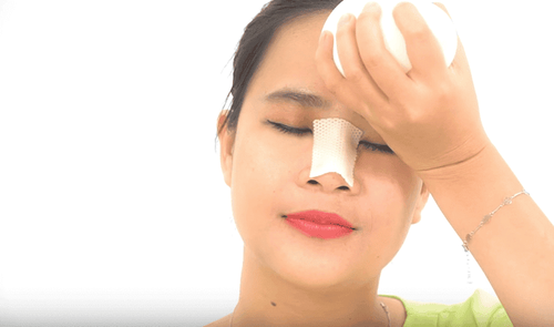 Is ear cartilage rhinoplasty permanent? This is a question of many people who are planning to get a rhinoplasty.

