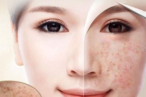 The etiological factors for the development of freckles may be attributed to genetic predisposition or frequent exposure to solar radiation.