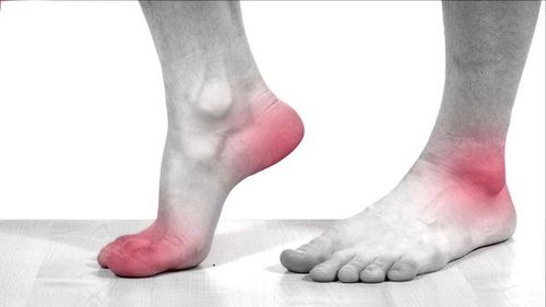 Người bệnh tiểu đường không nên tập thể dục khi có những vết thương hở ở bàn chân