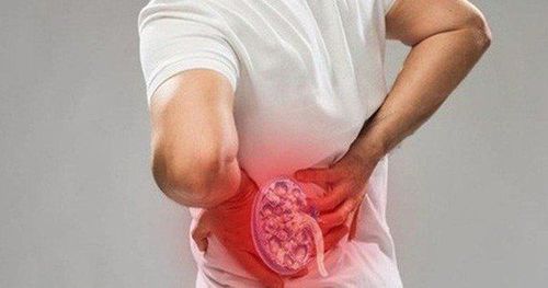 Home remedies and treatments for kidney stones
