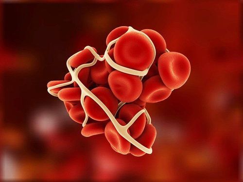 Một số vấn đề trên bệnh nhân rối loạn đông cầm máu