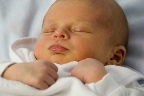 Trẻ sinh non thường có nguy cơ bị vàng da