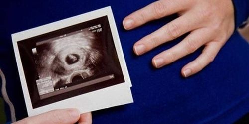 Thai tuần thứ 6 có tim thai nhưng tuần thứ 9 không có là tim thai do đâu?