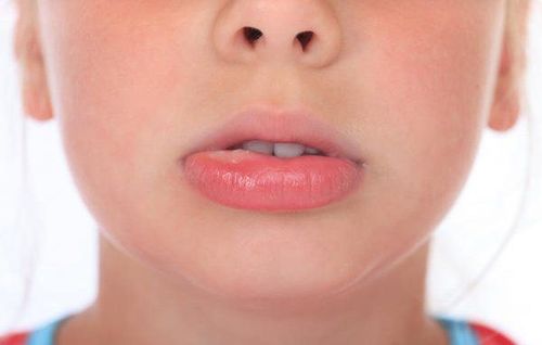 Oral Allergy Syndrome