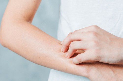 Dị ứng chanh có thể dẫn đến ngứa, nổi mụn nước