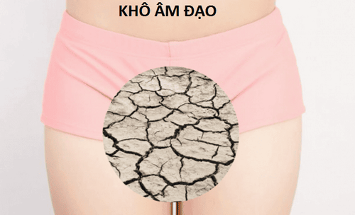 Khô âm đạo là tình trạng âm đạo bị mất độ ẩm thông thường