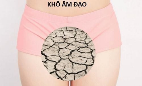 Vaginal dryness is one of the common symptoms experienced by women aged 40 to 50.