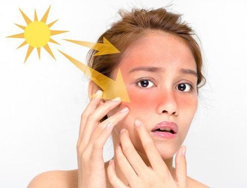 Tránh xa mặt trời là một cách chăm sóc da sau bắn laser tàn nhang
