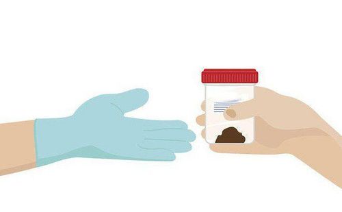 Bệnh nhân COVID-19 có calprotectin trong phân là dấu hiệu của bệnh viêm ruột