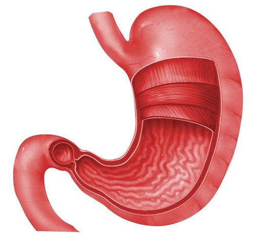U dưới niêm mạc dạ dày có nguy hiểm không?