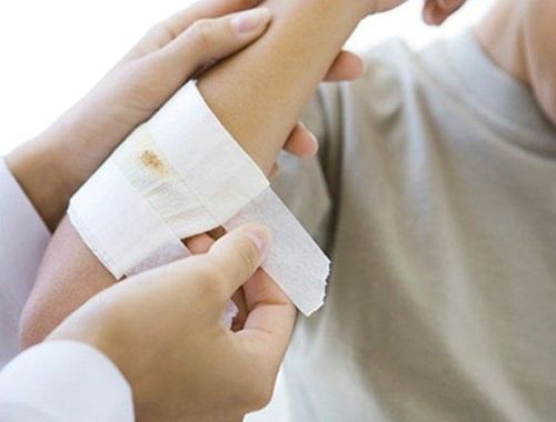 Should an open wound be completely covered?