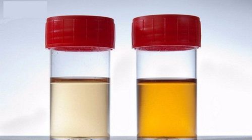 If the postoperative urine appears milky, it may indicate proteinuria
