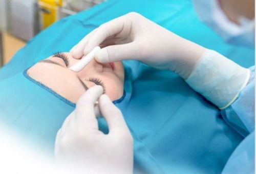 Surgiform cartilage rhinoplasty is trusted by many people