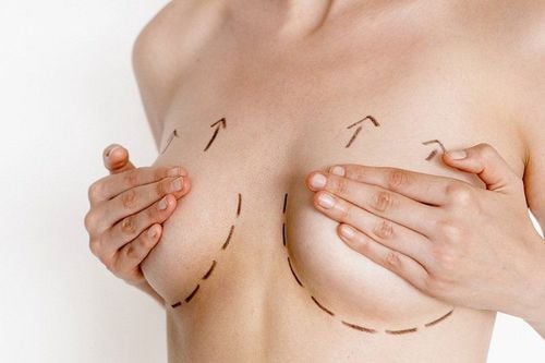 5 Benefits of Breast Massage