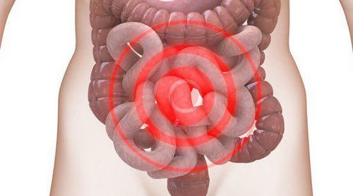
Bác sĩ sẽ chẩn đoán hội chứng ruột kích thích dựa trên các triệu chứng của bạn.

