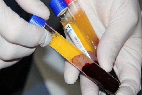 
Nồng độ vitamin trong huyết thanh khác nhau ở những bệnh nhân có khối u khác nhau
