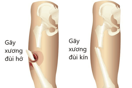 Slide item