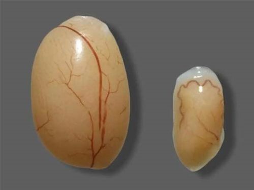 One testicle is atrophied, can I still have children?