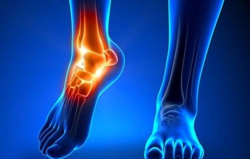 Viêm khớp cổ chân gây ra nhiều biến chứng nguy hiểm tới sức khỏe.