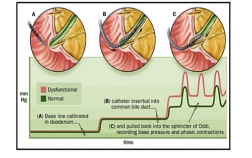 Some exogenous agents relax the sphincter of Oddi, reducing its pressure and resistance