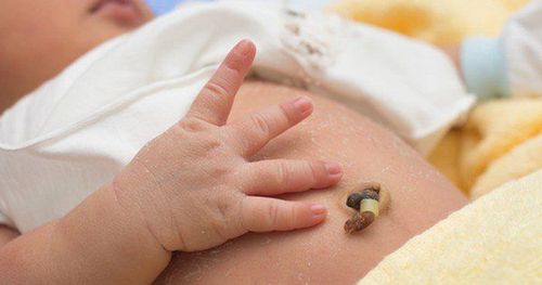Bé sơ sinh rụng rốn 15 ngày nhưng bị chảy máu có sao không?